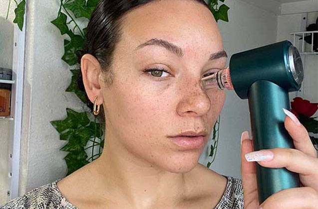 5 Benefits of Using a Pore Vacuum to Remove Blackheads on Your Nose