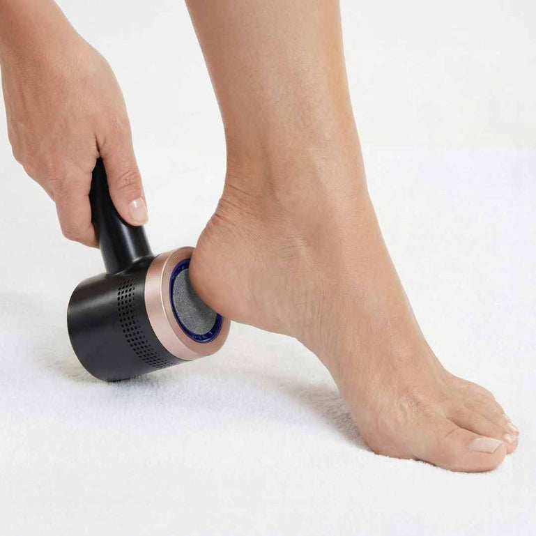Fancii Cali electric callus remover with vacuum for dry cracked feet Black None Black With Replacement Heads
