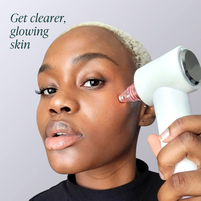 Fancii Clara pore suction vacuum cleanser microdermabrasion device in Pearl White
